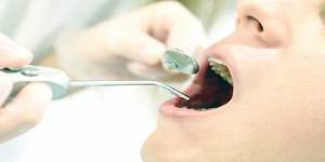 ホーチミンの歯科医院での一般的な歯科治療の費用