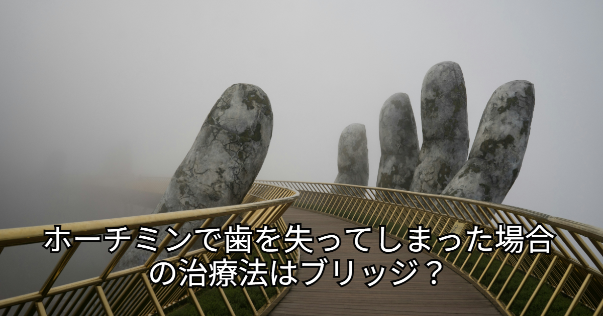 ダナンのブリッジ
