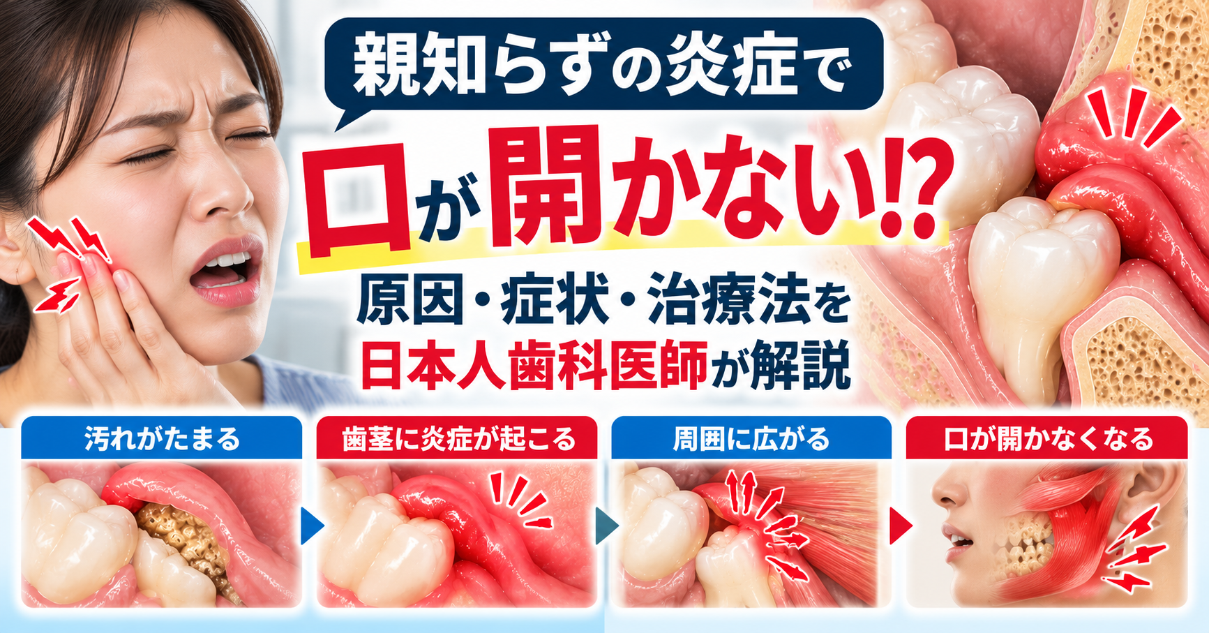 親知らずや顎関節症が原因で口が開かなくなる時の説明