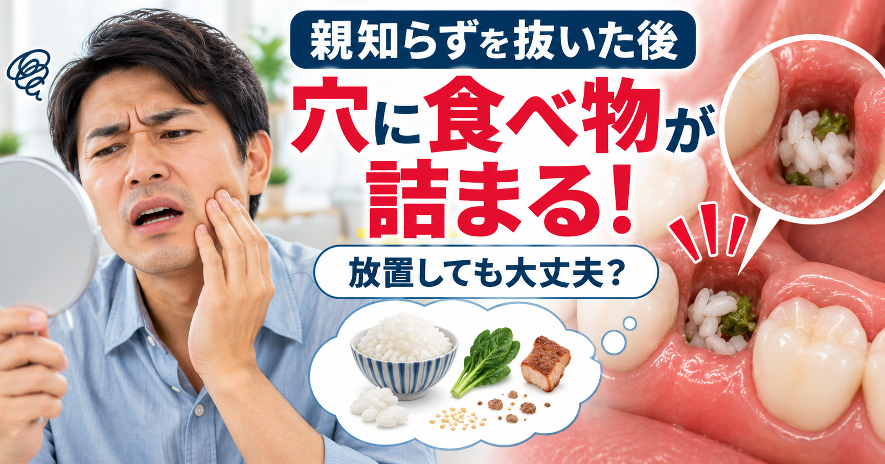 抜歯後の穴に食べ物詰まっても大丈夫？の説明