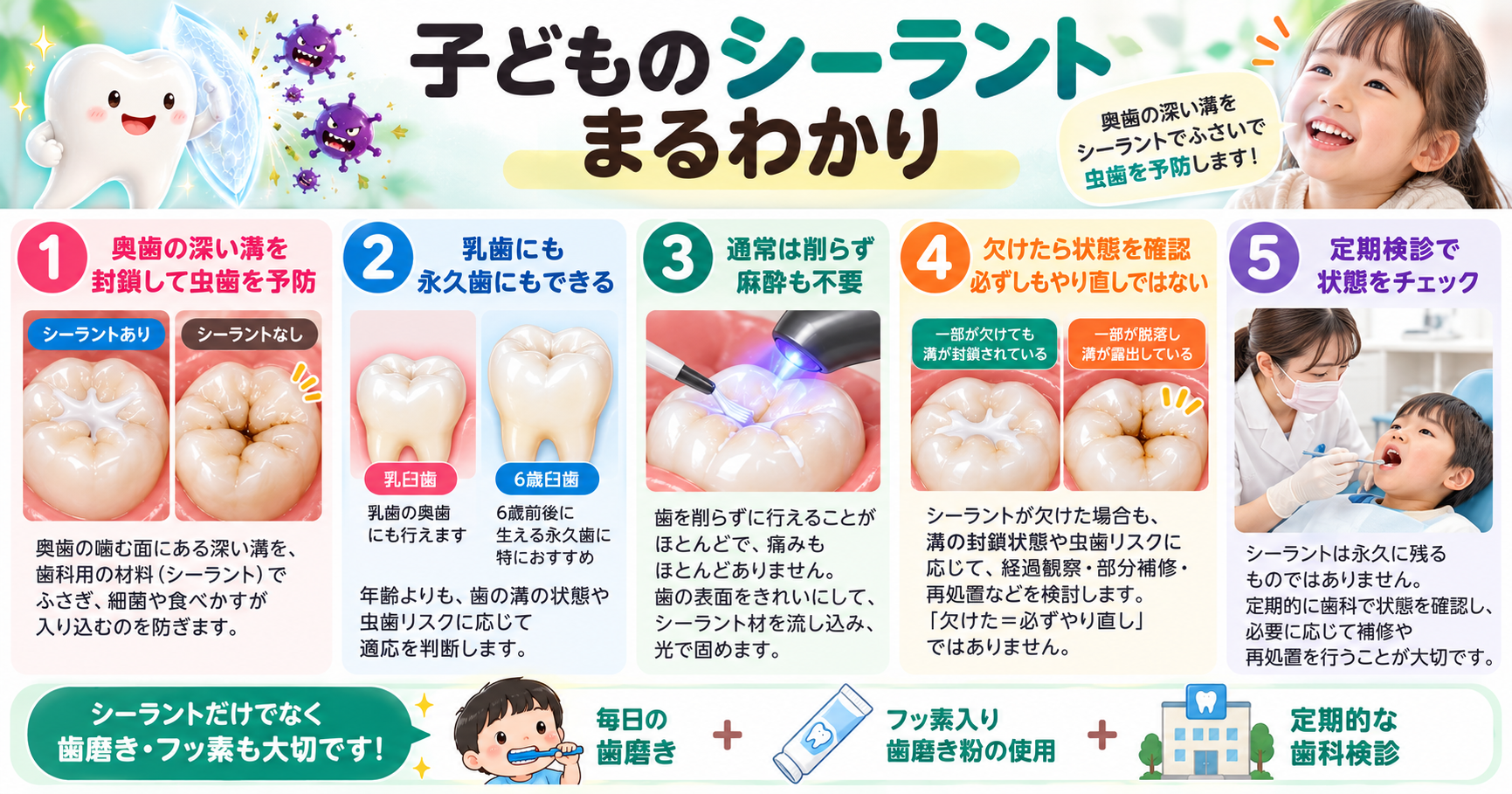 こどものシーラントを細かく説明した図